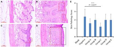 Screening and evaluation of skin potential probiotic from high-altitude Tibetans to repair ultraviolet radiation damage